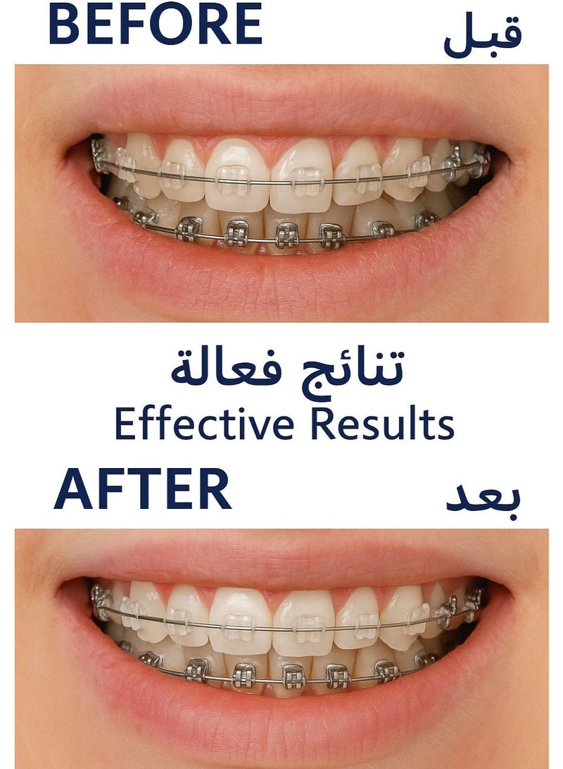 نورسينا عناية شاملة لابتسامتك! مجموعة العناية بالتقويم من نورسينا - لنتائج فعالة وراحة دائمة. - Image 2