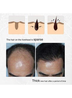 Lanthome Hair Growth Spray Onion Oil For Hair Growth Organic Hair Growth Serum Enriched With Rosemary Black Seed Oil Control Hair Loss Promotes Hair Growth  - Image 4
