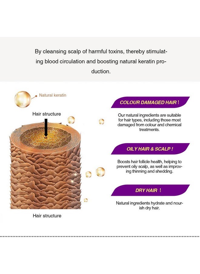 Lanthome - Hair Growth Spray Onion Oil For Hair Growth Organic Hair Growth Serum Enriched With Rosemary Black Seed Oil Control Hair Loss Promotes Hair Growth - Image 1