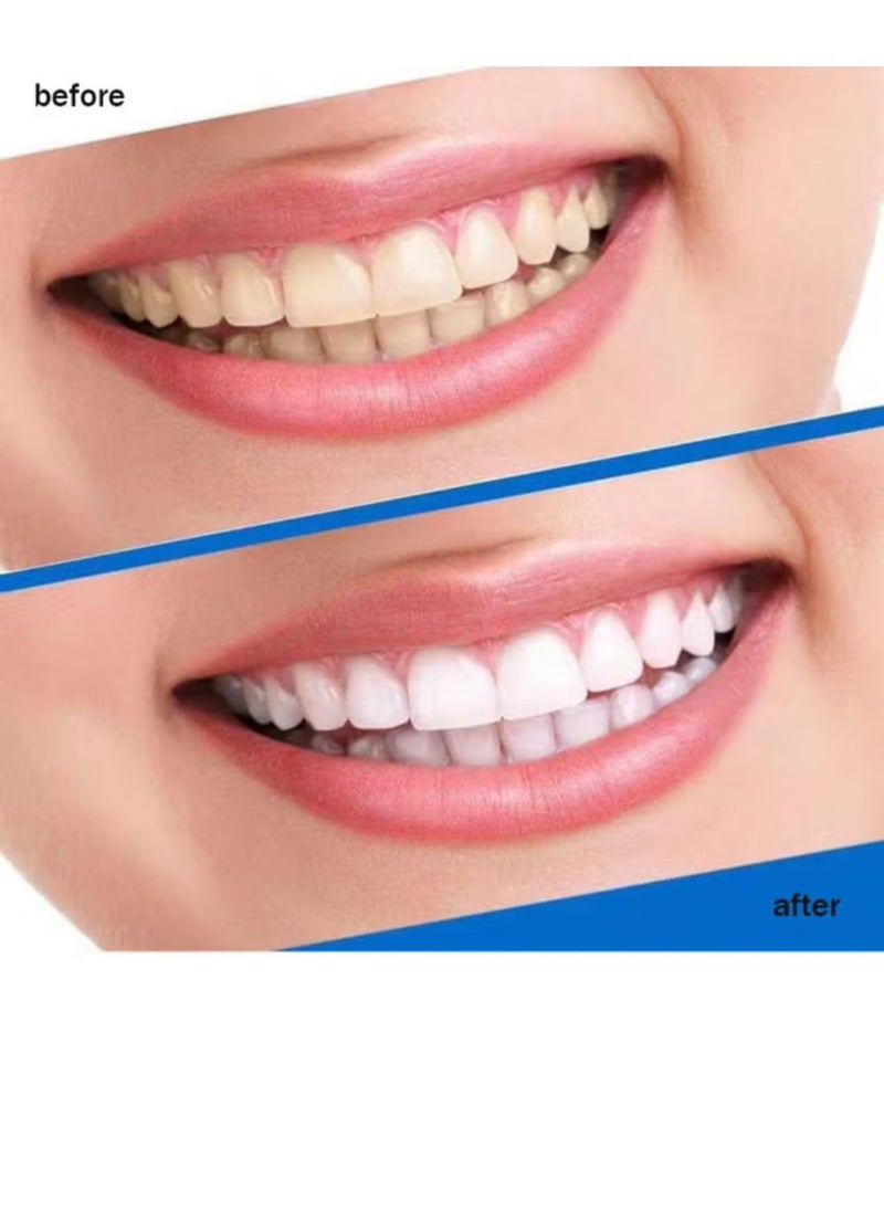 VILILY - 7-Pieces 5D Teeth Whitening Strips - Image 1