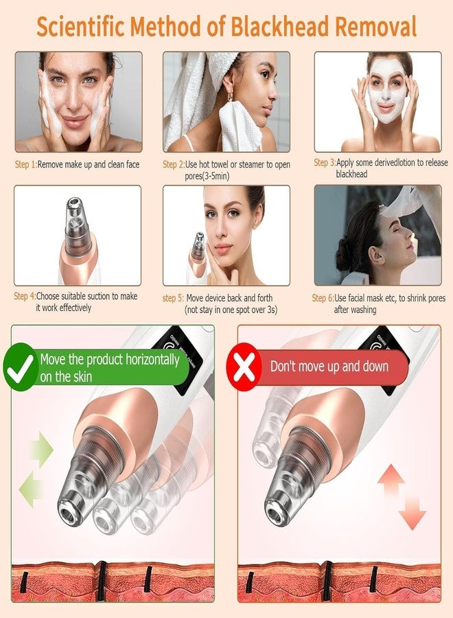 Adiguru 5-in-1 Blackhead Remover Machine – Electric Pore Cleaner & Whitehead Removal Tool, Deep Face Cleaner Machine for Acne, Pimple & Blackhead Removal, USB Rechargeable Derma Suction Device (Blackhead remover) - Image 4