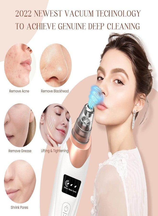 Adiguru 5-in-1 Blackhead Remover Machine – Electric Pore Cleaner & Whitehead Removal Tool, Deep Face Cleaner Machine for Acne, Pimple & Blackhead Removal, USB Rechargeable Derma Suction Device (Blackhead remover) - Image 2