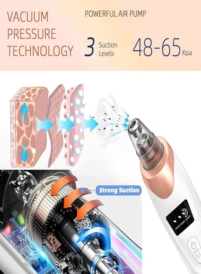 Adiguru 5-in-1 Blackhead Remover Machine – Electric Pore Cleaner & Whitehead Removal Tool, Deep Face Cleaner Machine for Acne, Pimple & Blackhead Removal, USB Rechargeable Derma Suction Device (Blackhead remover) - Image 3