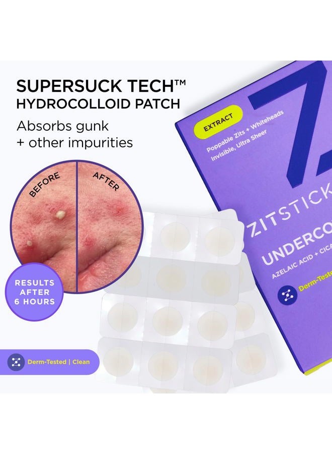 ZITSTICKA Invisible, Ultra-Sheer Hydrocolloid Patches | UNDERCOVER Blemish Patches to Help Calm Skin and Redness of Blemishes | Zit Patch and Pimple Stickers - Image 5