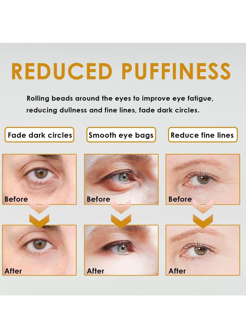 Oil 2 Pcs Time Eraser Roller Ball Castor Oil, Castor Oil Frankincense Rollerball, Time Eraser Rollerball Castor Oil for Eyes, Bags Under Eyes - Image 3