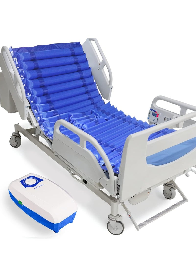 XiuWoo Pressure Mattress Topper with Ultra Quiet Alternating Pump, Mattress with Hole for Urine, Alternating Air Pressure Mattress, Alternating Air Pressure Mattress for Bed Sores Pad, blue  - Image 1