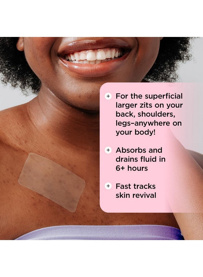 ZITSTICKA Goo Getter Body Clarifying Blemish Patches - Image 5