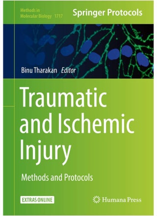 Traumatic and Ischemic Injury: Methods and Protocols - pzsku/Z6DA755C05584391FFB0AZ/45/_/1727204396/14da2484-f551-4751-aa25-037a275c8603