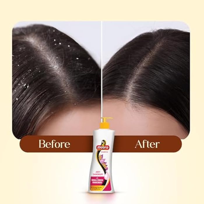 Meera Anti Dandruff Shampoo, White,340ml' - Image 5