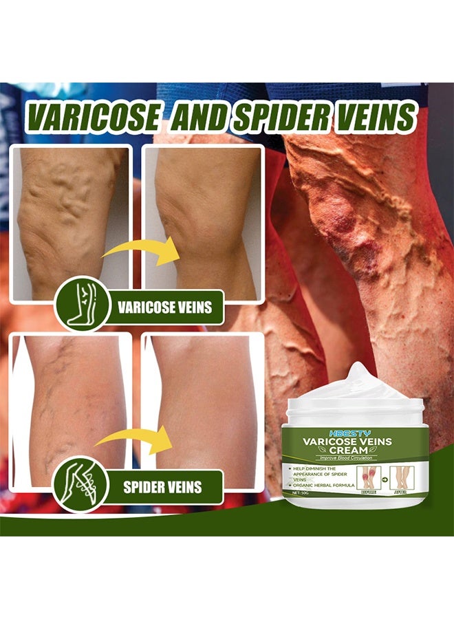 HBESTY Varicose Veins Cream, Soothing Leg Cream, Varicose And Spider Veins Treatment Cream, Improve Blood Circulation, Fast Relieve Swelling Pain 50G - Image 4
