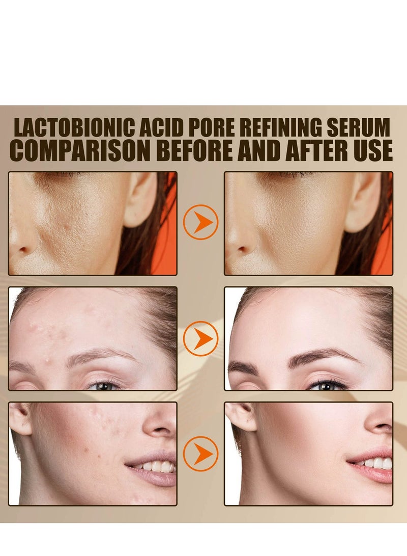 إيلهو مصل تنقية المسام من حمض اللاكتوبيونيك - مصل شد البشرة وتقليل المسام للرجال والنساء ، المسام الكبيرة ، تقليل الرؤوس السوداء وتحسين ملمس البشرة ، تقليص المسام تقليل الخطوط الدقيقة سائل الوجه 30 مل - Image 5