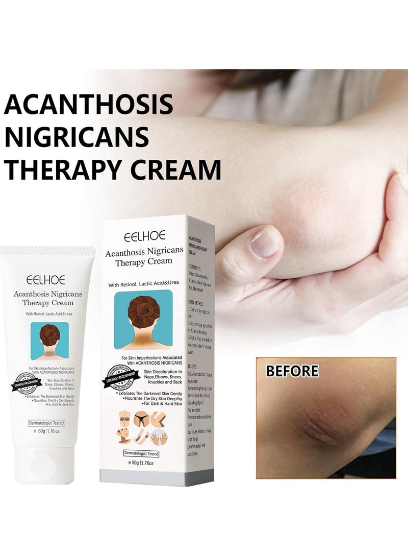 EELHOE Acanthosis Nigricans Therapy Cream- with Lactic Acid ,Dermatologist Tested Retinol Cream , Hyperpigmentation Removal Cream , For Dark Body Parts like Neck Ankles Knuckles Armpits 50g - Image 3