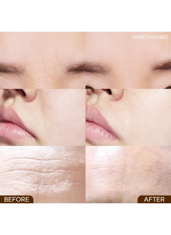 Wrinkle Repair Patches For Frown Lines Smile Lines Forehead Lines The Anti Wrinkle Patch Non Invasive Wrinkle Smoothers For Face Wrinkles Korea Beauty Overnight Face Treatment