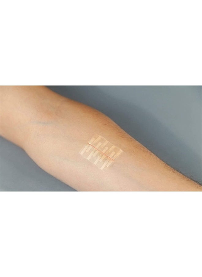 Clozex - Emergency Laceration Closures - Repair Wounds Without Stitches. FDA Cleared Skin Closure Device for 3 Individual Wounds Or Combine for Total Length of 4 1/4 Inches. - Image 1