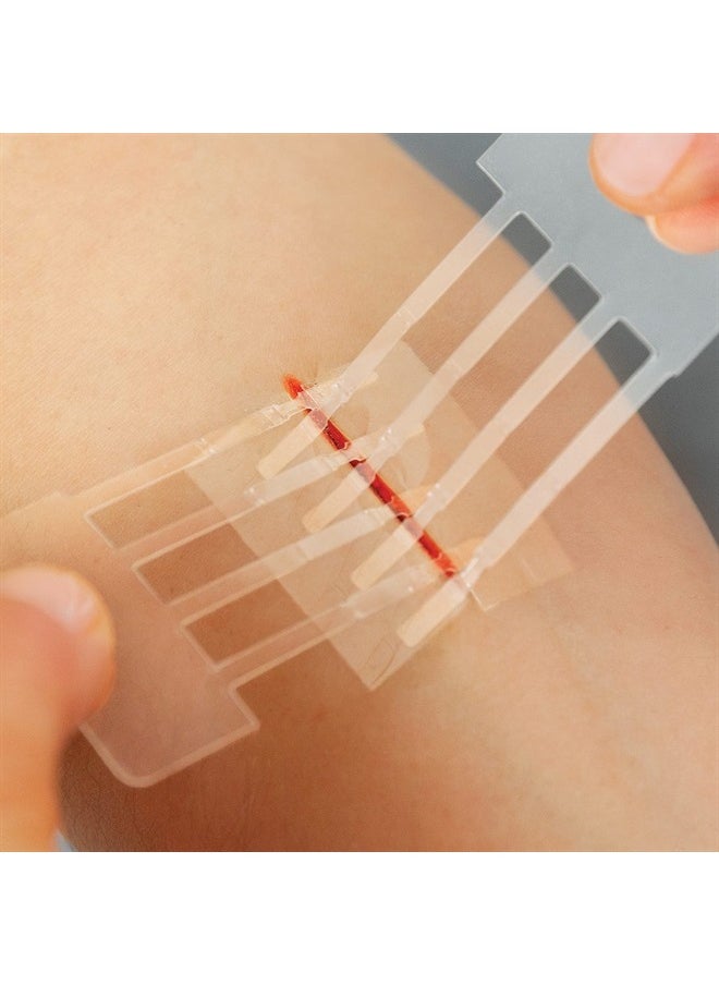 Clozex - Emergency Laceration Closures - Repair Wounds Without Stitches. FDA Cleared Skin Closure Device for 3 Individual Wounds Or Combine for Total Length of 4 1/4 Inches. - Image 1
