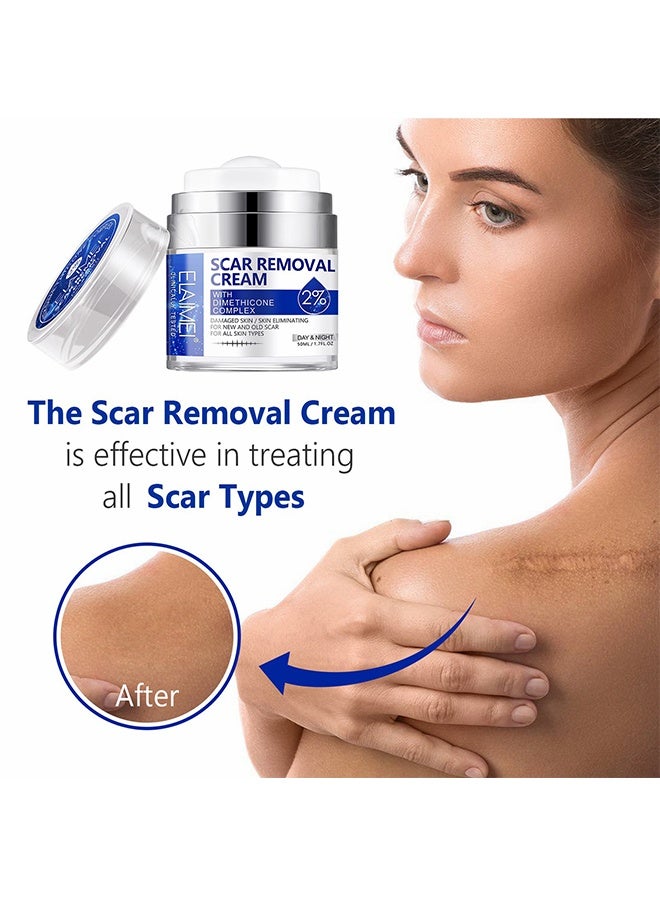 إيلهو كريم إزالة الندوب بمركب ديميثيكون 2% تأثير سريع للندوب الجديدة والقديمة الناتجة عن الحمل والحروق وندوب العمليات لإصلاح الجلد التالف وتغذية وتفتيح البشرة 50 مل - Image 5
