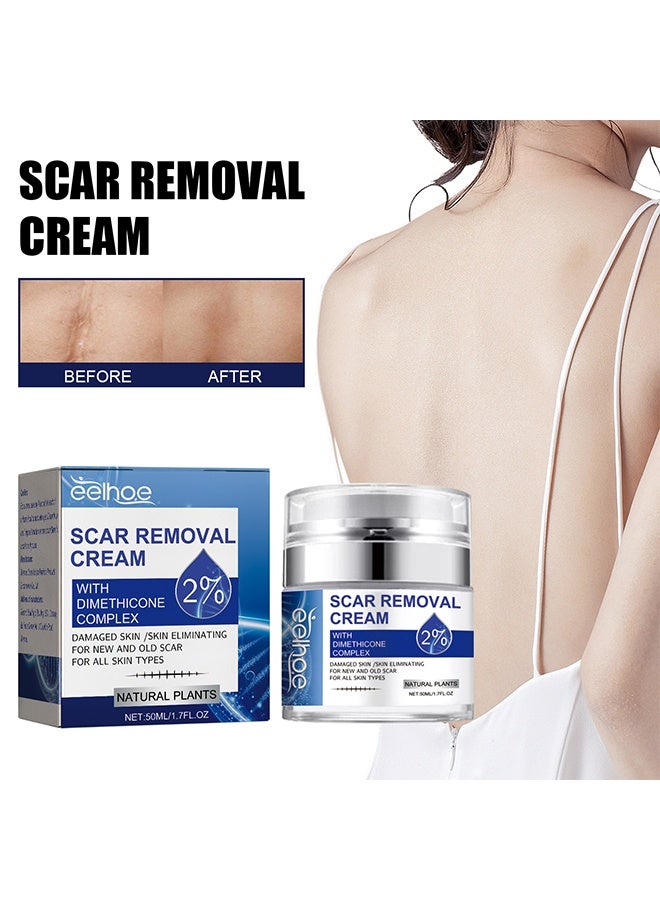 إيلهو كريم إزالة الندوب بمركب ديميثيكون 2% تأثير سريع للندوب الجديدة والقديمة الناتجة عن الحمل والحروق وندوب العمليات لإصلاح الجلد التالف وتغذية وتفتيح البشرة 50 مل - Image 1