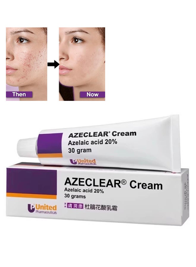يونايتد كريم أزيكلير 30 غ، 20 ٪ كريم أزيلي حمض، تقليل حب الوجه، البليميشات و الوردية وإصلاح تغير لون الجلد، الرطوبة والتوازن سيبوم - Image 1