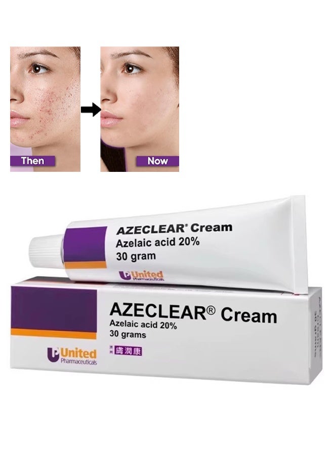 United Azeclear Cream 30g, 20% Azelaic Acid Cream, Reduce Face Acne, Blemishes and Rosacea and Repair Skin Discoloration, Moisturizes and Balances Sebum - Image 1