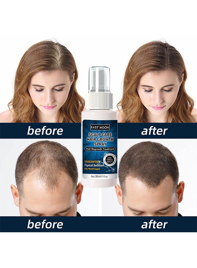 East Moon Scalp Care Hair Growth Spray-Ultra Hair Growth Formula Serum Spray, Grow Thicker Hair In 8 Weeks-30ML - Image 4
