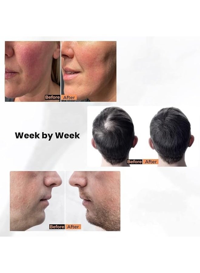 Hewan 140 Titanium Adjustable Micro Needles Facial Derma Roller Kit for Skin Repair, Face, Hair & Beard Growth - Image 5