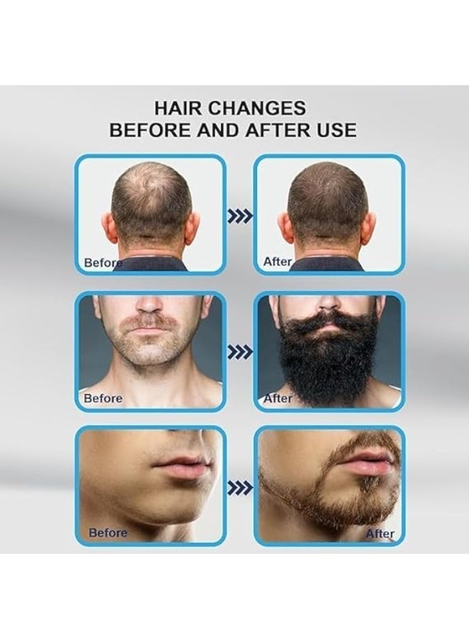 Hewan 140 Titanium Adjustable Micro Needles Facial Derma Roller Kit for Skin Repair, Face, Hair & Beard Growth - Image 3