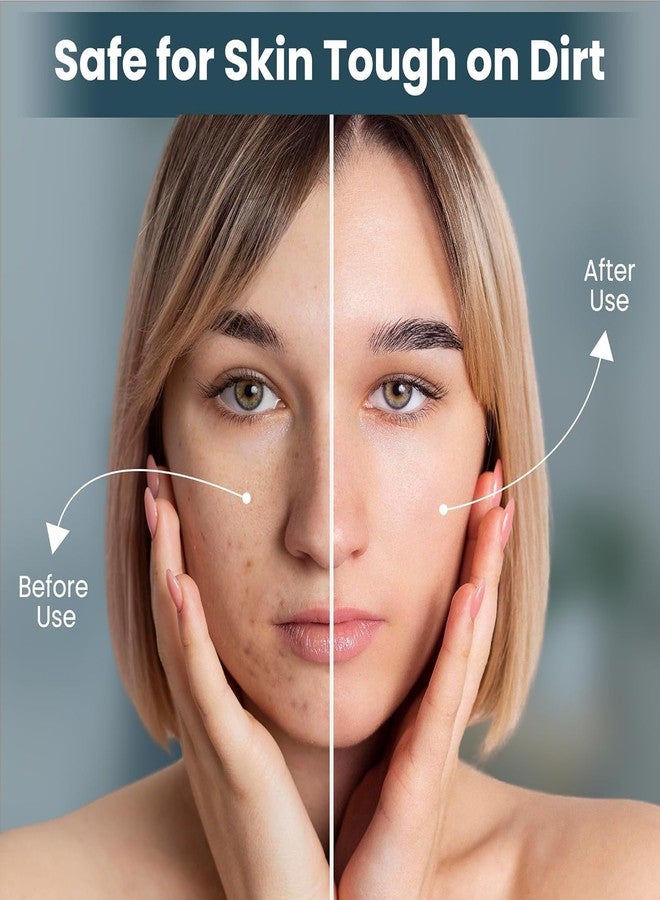 GOMNIK Soft Silicone Face Scrubber for Deep Cleansing & Gentle Exfoliation | Facial Cleansing Brush Pad for Removing Dead Skin, Blackheads & Oil | Reusable Hygienic Face Massage Cleaner for Men & Women (Grey) - Image 5