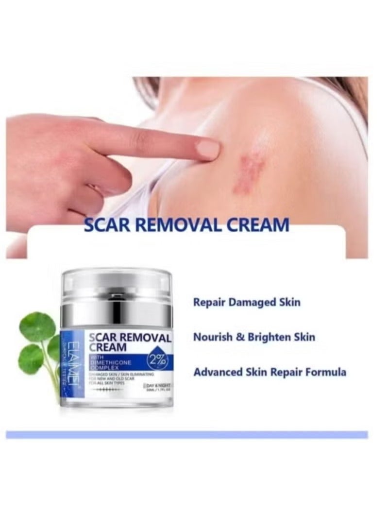 إليمي كريم إزالة ندبة و علامة التمدد مع مجمع ديميثيكون أضاف 100٪ ندبة خالية من الرتينول من الجلد المتضرر وعلاج إزالة ندبة جديدة + قديمة عوامل إصلاح الجلد الطبيعية يونيسكس 50 مل - Image 3
