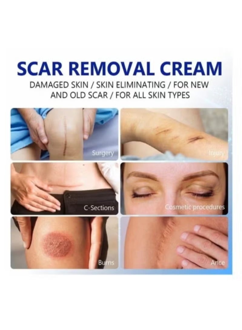 إليمي كريم إزالة ندبة و علامة التمدد مع مجمع ديميثيكون أضاف 100٪ ندبة خالية من الرتينول من الجلد المتضرر وعلاج إزالة ندبة جديدة + قديمة عوامل إصلاح الجلد الطبيعية يونيسكس 50 مل - Image 4