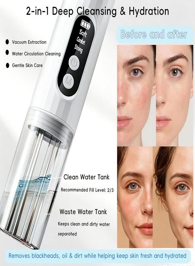 HOERCAAL Pore Vacuum Blackhead Remover, 2-in-1 Hydrating Facial Cleansing Tool, 3 Suction Levels, 6 Replaceable Heads, Deep Pore Cleaning for Blackheads & Blemishes - Image 2