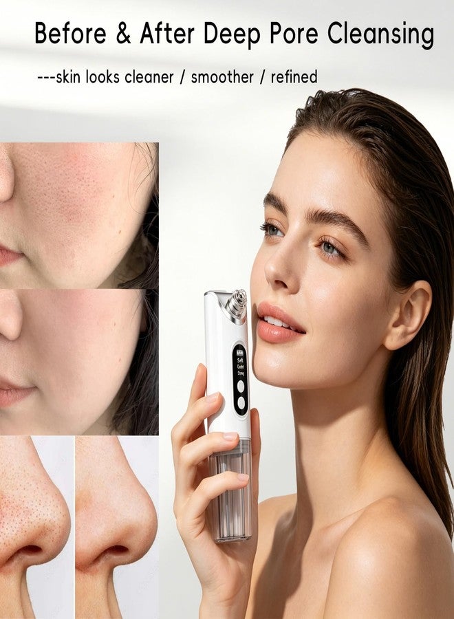 HOERCAAL Pore Vacuum Blackhead Remover, 2-in-1 Hydrating Facial Cleansing Tool, 3 Suction Levels, 6 Replaceable Heads, Deep Pore Cleaning for Blackheads & Blemishes - Image 5