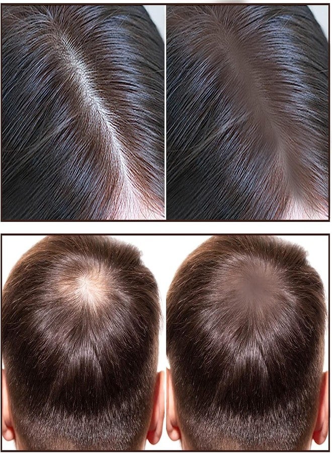 VBA Hair Shadow Powder Hairline Powder Stick Thinning Hair, Root Touch-Up Powder Quickly Cover Hair Fall Hair Root Concealer for Hair Loss (BROWN) - Image 5