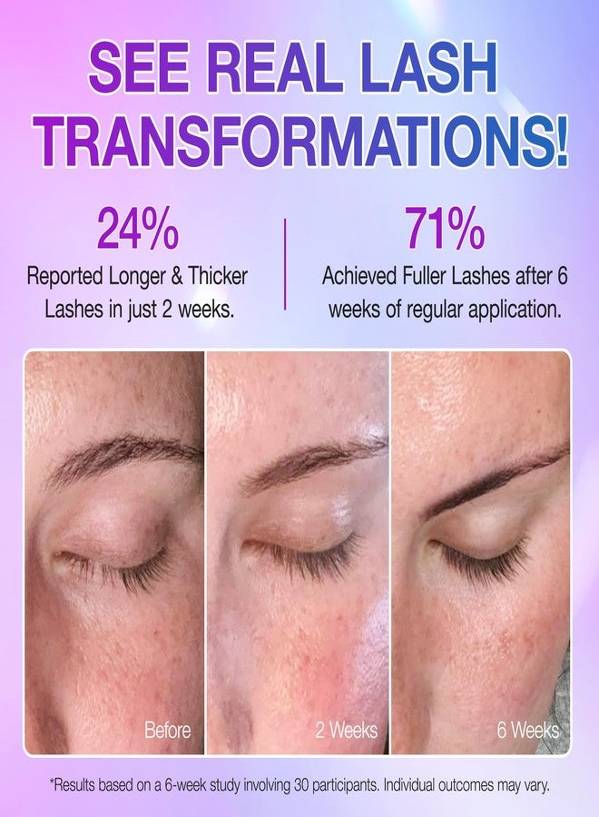 Eyelash Growth Serum - Natural Formula, Eyelash Serum for Longer, Denser & Robust, Boosts Natural Lashes and Brows Development, Visible Results in 4 Weeks - Vegan, Hormone-Free 5ml - Image 4