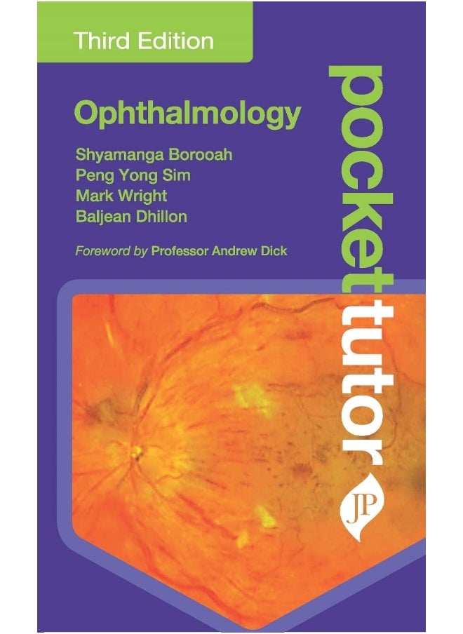 Pocket Tutor Ophthalmology 