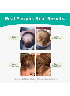 Shapiro MD Hair Growth Experts Shapiro MD Hair Growth Experts Vegan Hair Loss Shampoo for Thinning Hair | Experience Healthier, Fuller and Thicker Looking Hair (1 Month Supply)  - Image 5