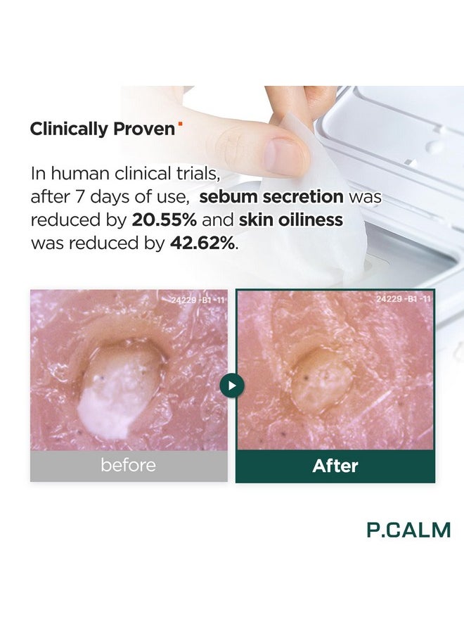 P.CALM P.CALM Barrier Cycle Daily Sheet Mask Pack 30 Days | Korean Non Comedogenic Daily Moisturizing Treatment Sheet Mask for Sensitive Skin | Vegan Cruelty Free  - Image 3