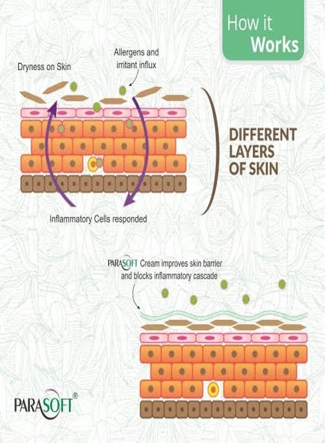 Parasoft Moisturizing Cream with Aloe Vera - 200g (Pack of 10) | Deep Hydration Intense Moisturizer for Dry & Dehydrated Skin, Non-Greasy, All-Season Daily Skincare, Dermatologist Tested, Paraben-Free - Image 5