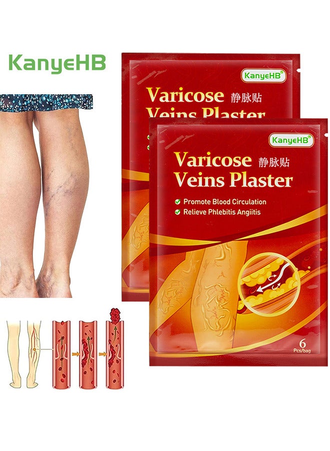 KanyeHB Varicose Veins Treatment Patch For Legs, Promote Metabolism And Improve Blood Circulation, Relief Heavy Tired Leg 12PCS - Image 1