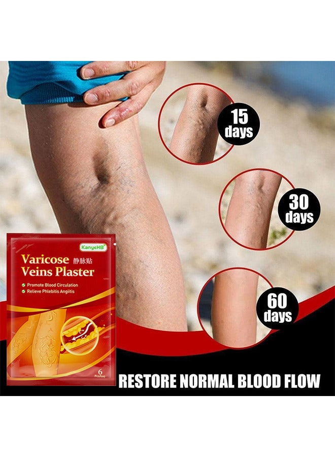 KanyeHB Varicose Veins Treatment Patch For Legs, Promote Metabolism And Improve Blood Circulation, Relief Heavy Tired Leg 12PCS - Image 4