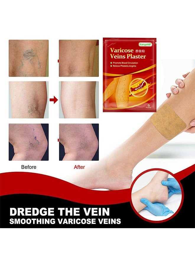 KanyeHB Varicose Veins Treatment Patch For Legs, Promote Metabolism And Improve Blood Circulation, Relief Heavy Tired Leg 12PCS - Image 3