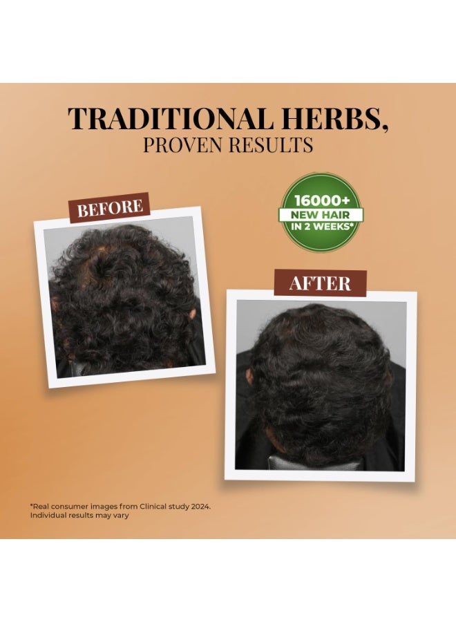 جاست هيربز سيروم "Just Herbs" الأيورفيدي لنمو الشعر – تغذية الجذور بـ 14 عشبة و7 مكونات نشطة فعالة ومثبتة | يعزز نمو الشعر، يقلل التساقط، ويقوي الجذور | يحتوي على Redensyl وAnaGain وإكليل الجبل والحلبة | 30 مل - Image 2