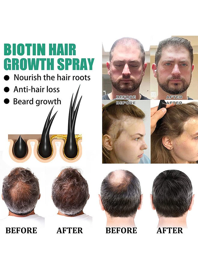 iBealee Biotin Hair Regrowth Serum Spray, Hair Essential Spray, Biotin Thickening Herbal Serum, Anti Hair Loss Serum For Hair Growth And Hair Loss, Hair Regrowth For Thicker Longer Fuller Hair - Image 5