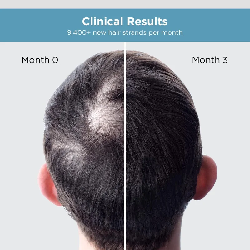 The Man Company  Hair Growth Serum for Men (30ml) with 3% Redensyl 4% Anagain 3% Biacapil | Stimulates Hair Growth | Prevents Hair Fall | Improves Hair Strength for Men | Best Price UAE
