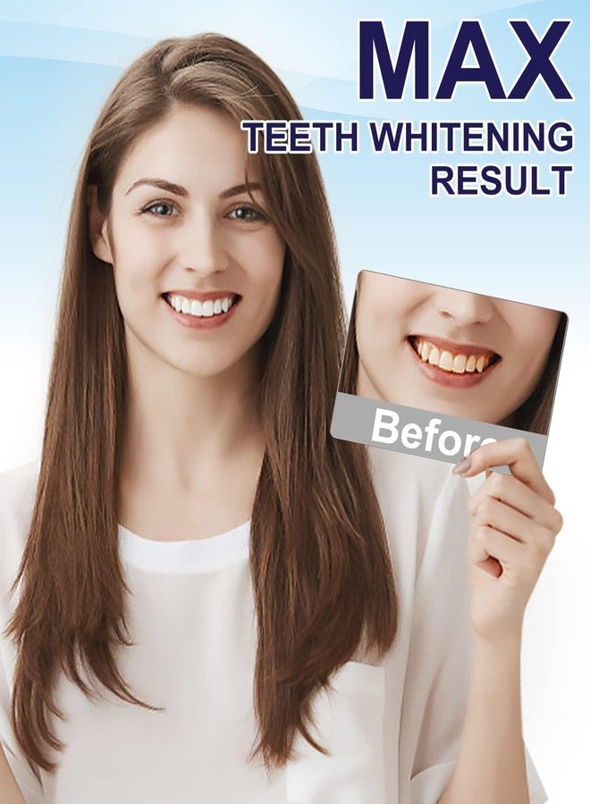 MySmile Teeth Whitening Strips Kit 14 Treatments with 28 LED Light - 10 Min Non-Sensitive Fast Whitening Teeth Enamel Safe Teeth Whitener - Helps to Remove Deep Stains - Image 5