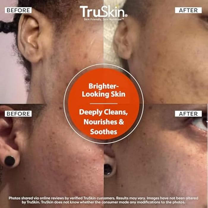 TruSkin ترو سكين منظف فيتامين سي للوجه - غسول تفتيح الوجه مع فيتامينات سي وإي، زيت الورد، الألوة فيرا وMSM - تنظيف عميق وانتعاش لبشرة مشرقة وصحية المظهر، 4 fl oz - Image 5