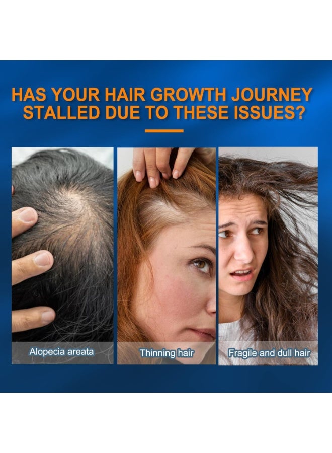 SKQIR 5% Minoxidil Foam for Men Women, 60ml 5% Minoxidil for Men Foam, Minoxidil for Women Hair Growth Suitable for Hair Thinning Receding Hairline and Hair Loss to Hair Regrowth Get Thicker Fuller Hair - Image 3