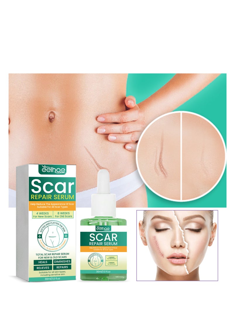 EELHOE Scar Repair Serum, Scar Removal Oil with Natural Ingredients, Suitable for Surgical Scars, C-Section, Stretch Marks, Acne, Injury, Burns, Keloids, Old and New Scars 30ml - Image 3