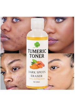 MOOYAM Turmeric Dark Spot Corrector Toner 100ml Facial Toner for Acne Prone Skin Dark Spot Remover for Face Hydrating Face Toner for Women Treatment for Dry Oily Skin  - Image 2