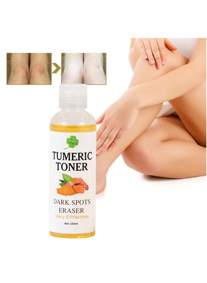 MOOYAM Turmeric Dark Spot Corrector Toner 100ml Facial Toner for Acne Prone Skin Dark Spot Remover for Face Hydrating Face Toner for Women Treatment for Dry Oily Skin  - Image 3