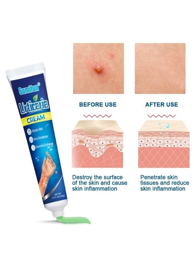 Sumifun 1-Piece Anti Itch Urticaria Cream Ointment for Allergic Reactions, Skin Rash Relief, Hives Treatment, Redness Reduction, Eczema Care, Dermatitis Support, Fast Acting Soothing Ointment 20g - Image 2